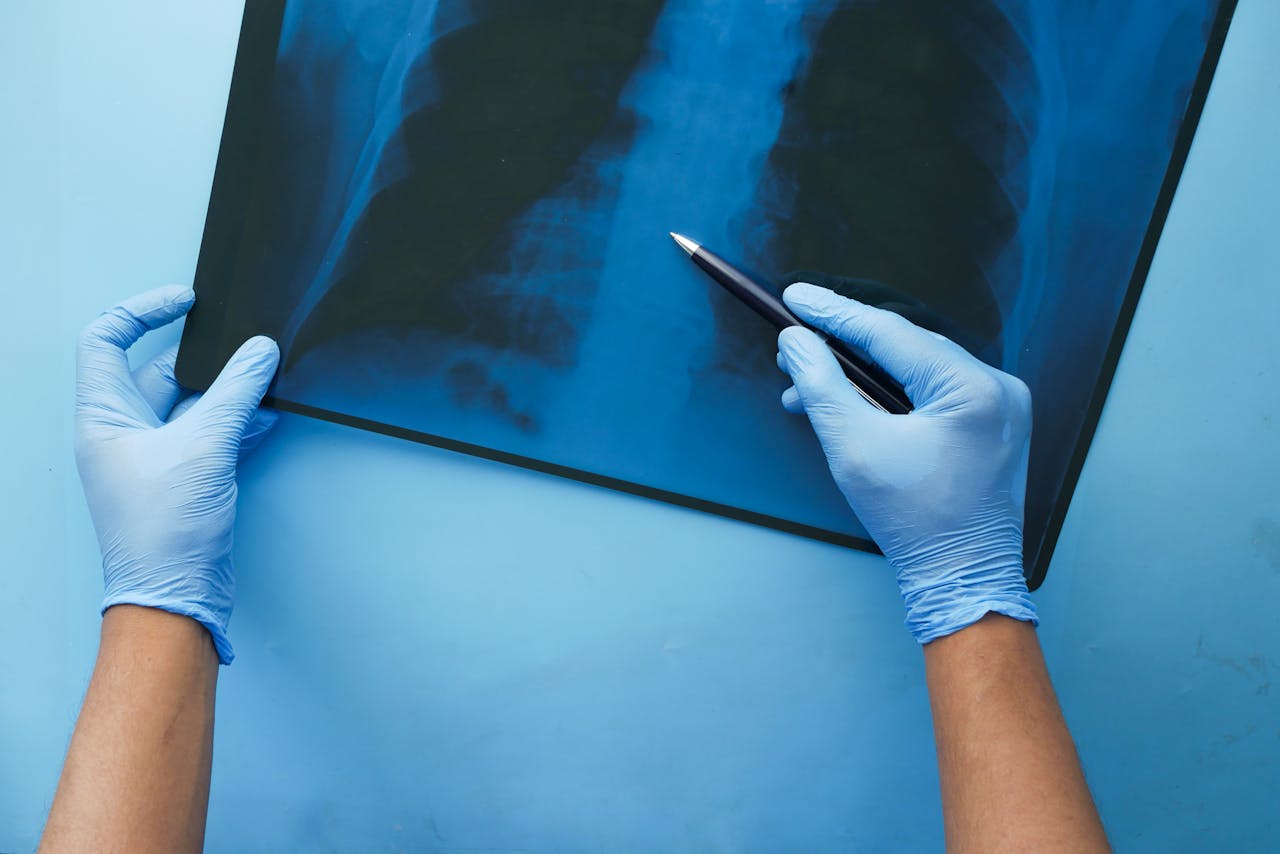 骨折癒合過程與營養支持的重要性